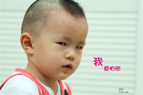 斜眼看人|孩子斜眼看人怎么回事